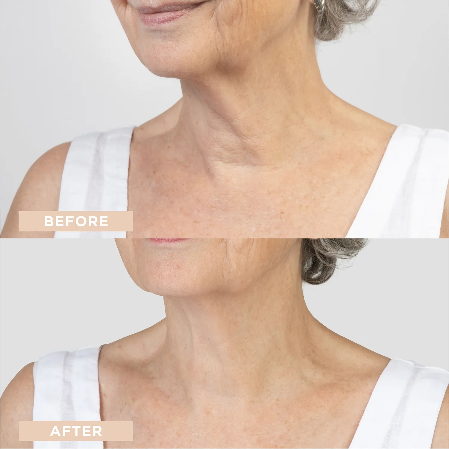 Lycon Neck Firming Cream halskräm 50ml fasthet