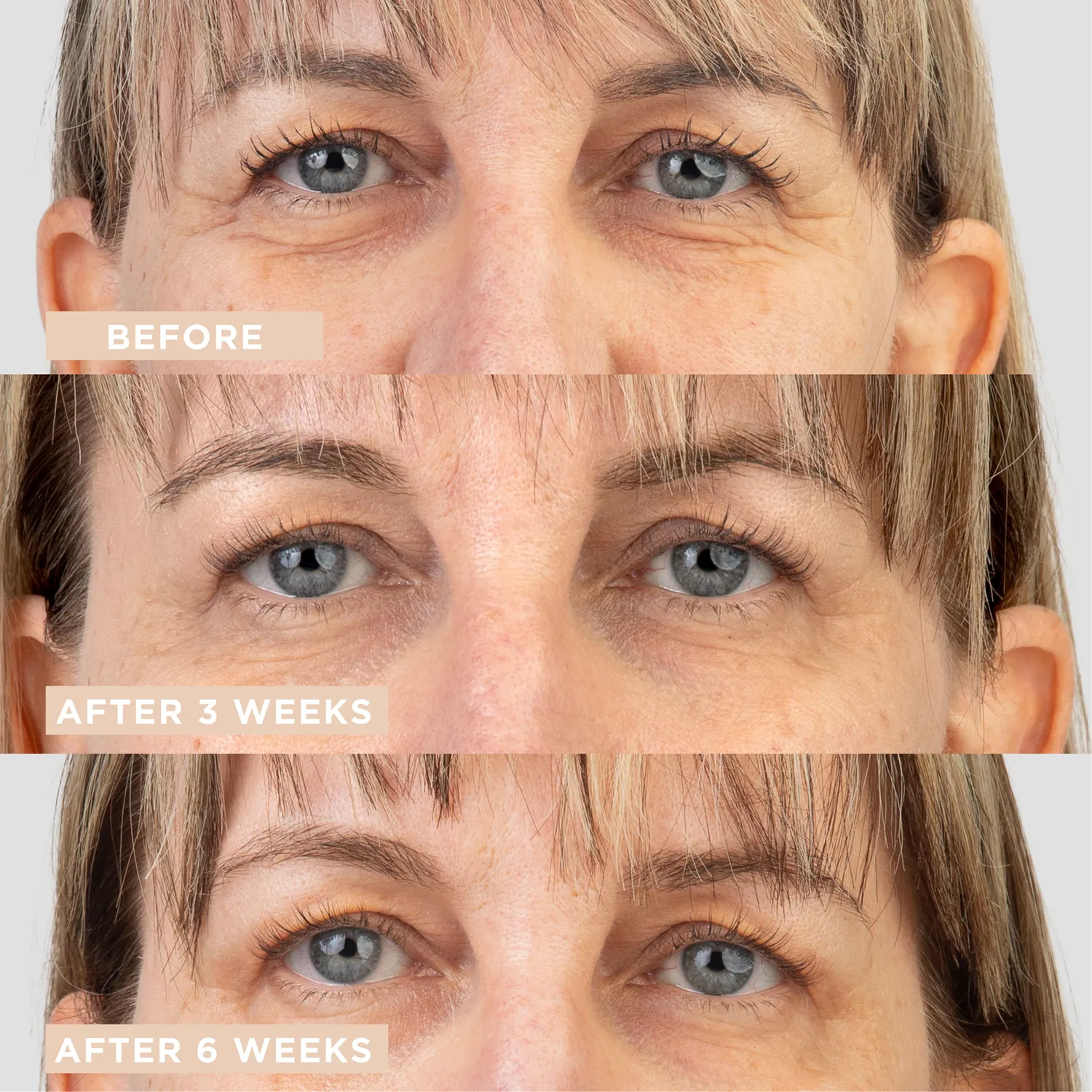 Lycon Eye Lifting Gel-Crème ögonserum 15ml fukt