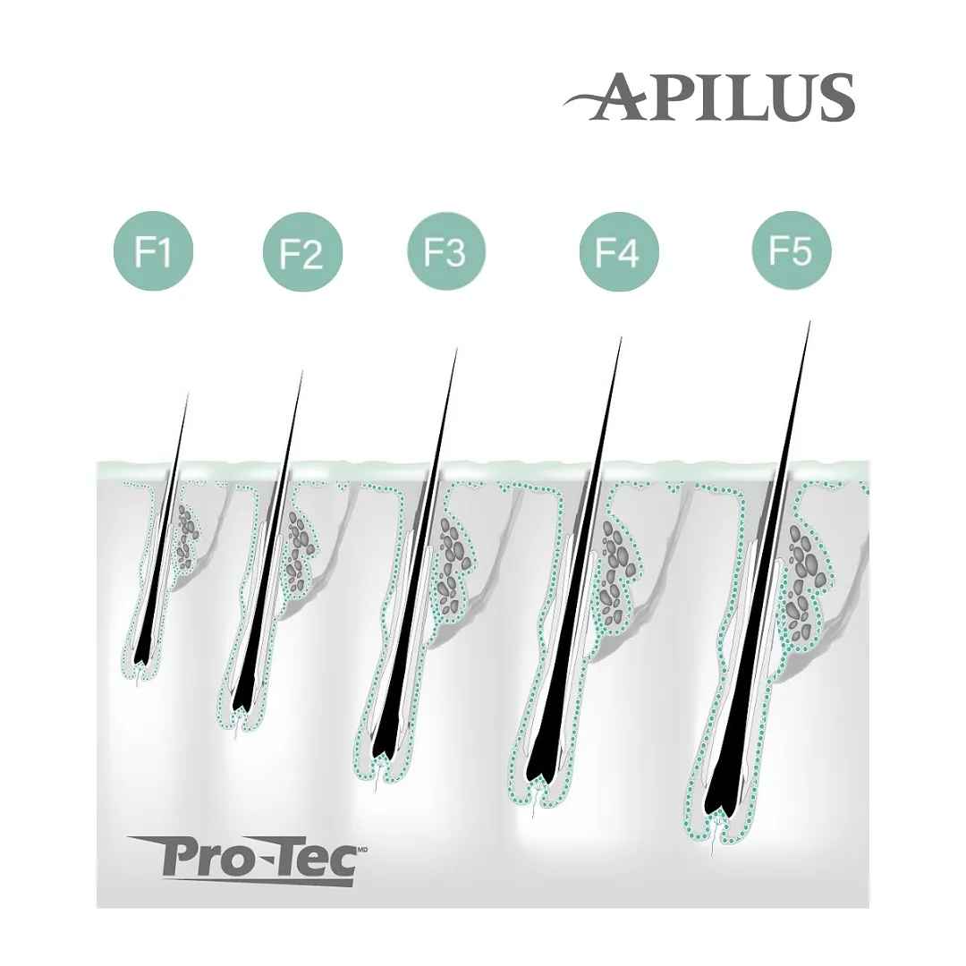 Apilus Pro-Tec filament elektrolys isolerade
